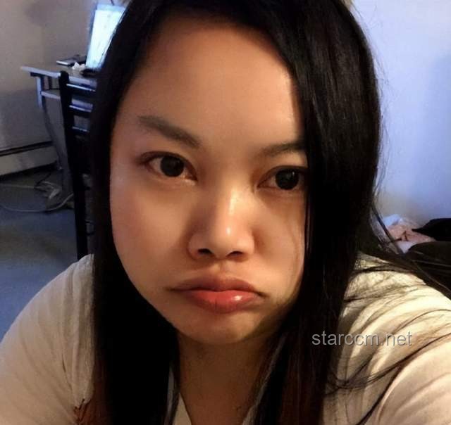 “牙烂了人胖了”问题解决方案：初代网红凤姐近况曝光引发的思考